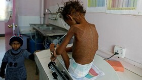 مرگ در یک قدمی ، کودکان یمن را نجات دهید